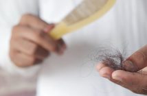 hair loss
